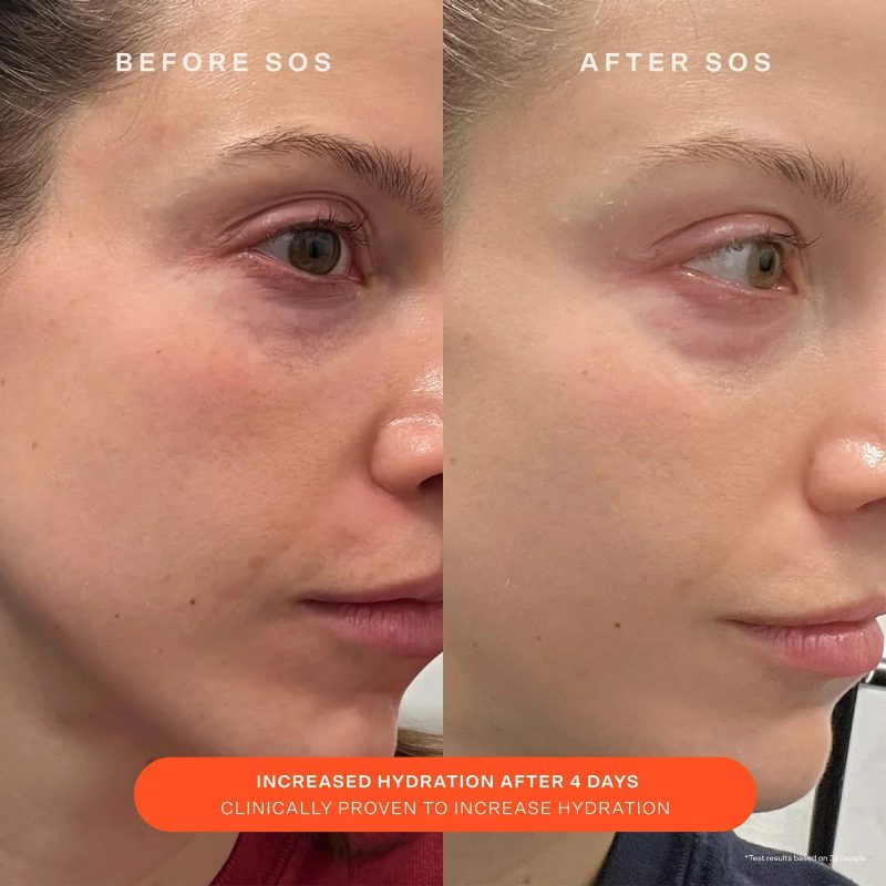 Tower 28 SOS Recovery Cream
